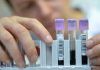 SSa, impulsa eliminación de la hepatitis C