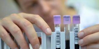 SSa, impulsa eliminación de la hepatitis C