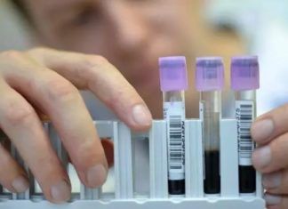 SSa, impulsa eliminación de la hepatitis C