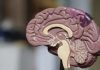 COVID-19 afecta gravemente al cerebro