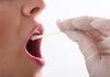 Saliva podría indicar gravedad de COVID-19