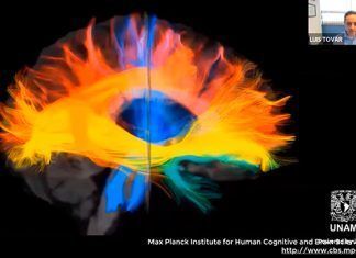 Infarto cerebral modifica conexiones neuronales