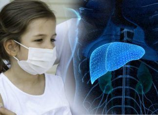 Hepatitis aguda