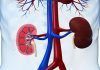 Sistema de salud mexicano, rebasado ante aumento de casos de enfermedad renal