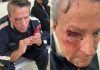 Golpean al actor Alfredo Adame