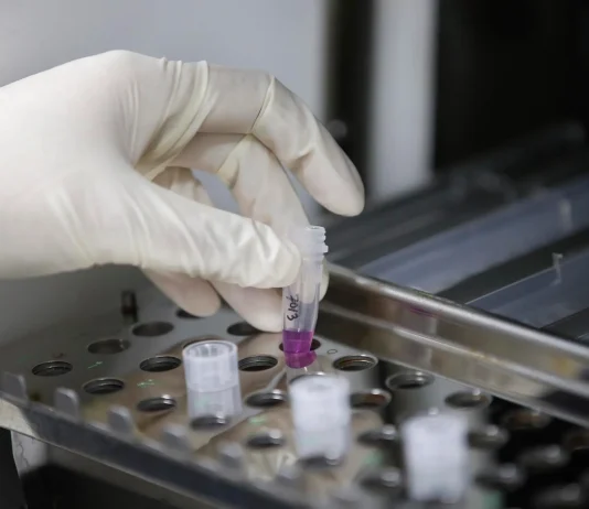 IMSS Bienestar atiende a más de 11 mil mujeres con cáncer en 200 días; presume reducción de tiempos de diagnóstico y tratamiento