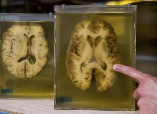 Nueva terapia abre la puerta a tratar la epilepsia