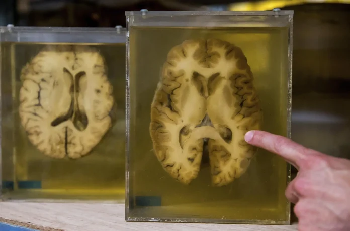 diseccion-de-cerebro