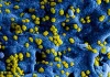 Bacterias responsables de infecciones sanguíneas que pueden ser letales