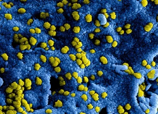 Bacterias responsables de infecciones sanguíneas que pueden ser letales