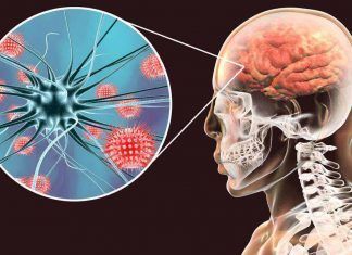 Durango / Reportan 36 muertos por brote de meningitis