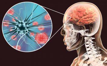 Durango / Reportan 36 muertos por brote de meningitis