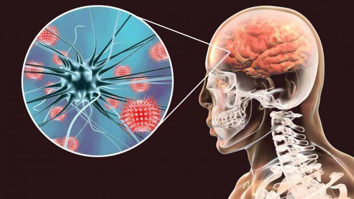 meningitis-que-es