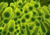 17 el total de bebés muertos por klebsiella oxytoca: SSA