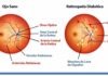 Fármaco contra retinopatía diabética