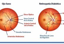 Fármaco contra retinopatía diabética