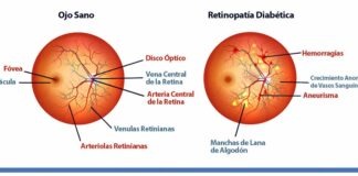 Fármaco contra retinopatía diabética