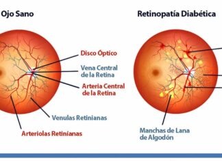 Fármaco contra retinopatía diabética