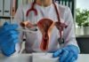 Campaña busca reducir brechas en cáncer cervicouterino