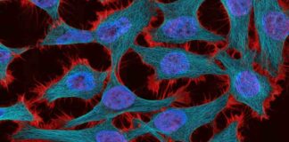 La estrategia de teragnosis contra el cáncer avanza en México hacia etapas tempranas