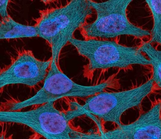 La estrategia de teragnosis contra el cáncer avanza en México hacia etapas tempranas